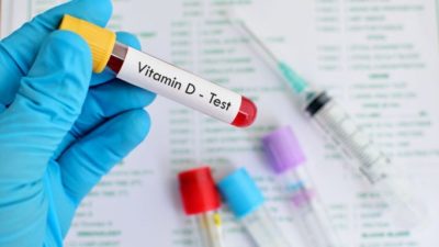 Vitamin D Testing Market