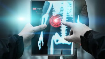 Digital Mobile X-Ray Devices Market