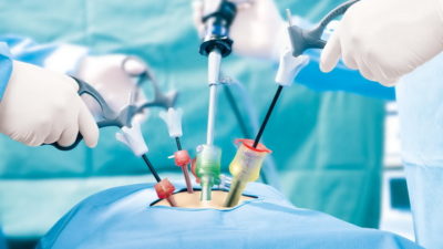 Obesity Surgery Devices Market