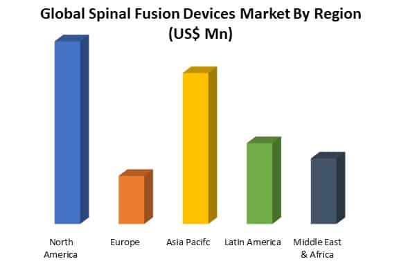 global spinal fusion devices market analysis by region