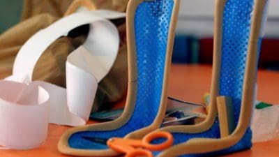 Casting and Splinting Market