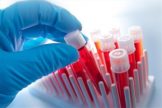 DNA Test Kits Market