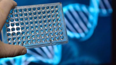 Next-Generation Sequencing Sample Preparation Market