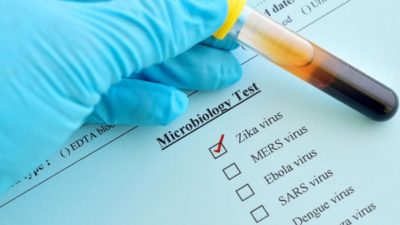 Zika Virus Testing Market
