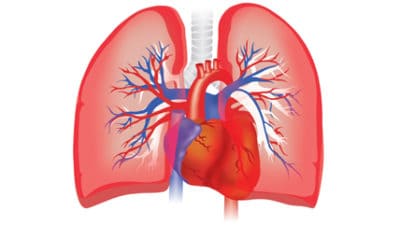 Pulmonary Arterial Hypertension Market