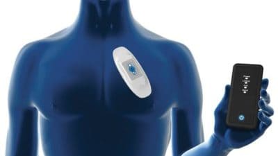 Mobile Cardiac Telemetry Systems Market