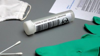 COVID-19 Detection Kits Market