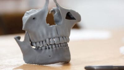 3D Medical Implants Market