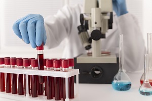Hemoglobin Testing Market